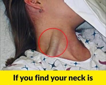 If you find your neck is bigger than usual, this is a sign you cannot ignore. – WowNews.info