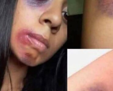 Young woman dies at the hands of her…See more – Daily News