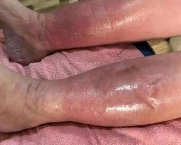 Signs on your FEET that indicate he is cr… see more – Daily News