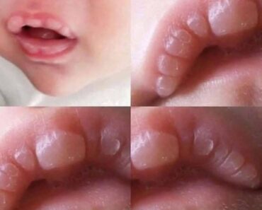 If your baby has these marks it means… See more