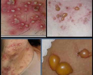 These are the signs that you are cr…See more – Daily News