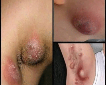 These are the signs that he is cr… See more
