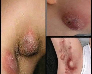 These are the signs that he is cr… See more