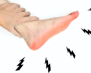HT10. Health Warning Signs on Your Feet You Should Never Ignore – Daily News