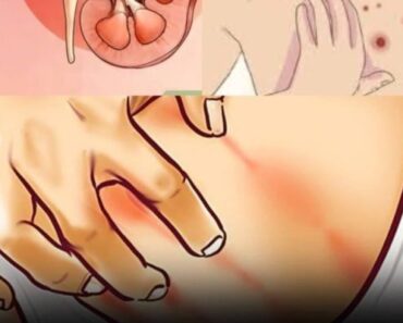 If Your Kidneys Are at Risk, Your Body May Display These 10 Warning Signs – readtime.store