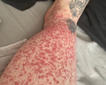 These are the consequences of sleeping with…See more – readtime.store
