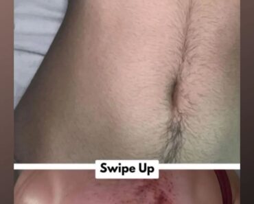 10 Warning Signs Your Body May Be Telling You Something’s Wrong