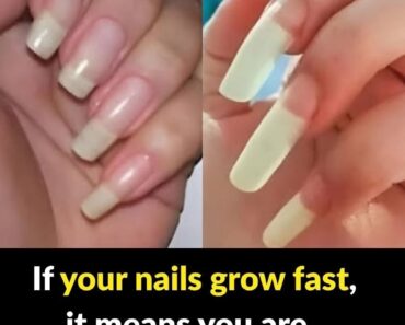 What It Really Means If Your Fingernails Grow Fast –