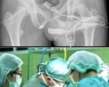 Girl was hospitalized for trying one more pen…See more – newzbust.com