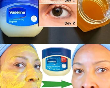 Vaseline Beauty Hacks: 11 Gentle Ways to Transform Your Skin & Hair Naturally