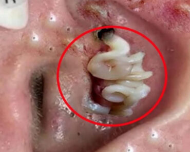 8 BODY Symptoms You Should Be Aware Of