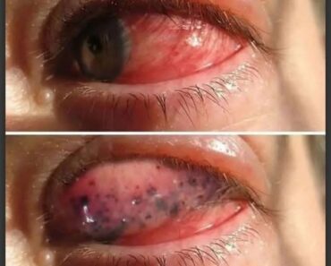 These are the consequences of sleeping with…See more – Daily News