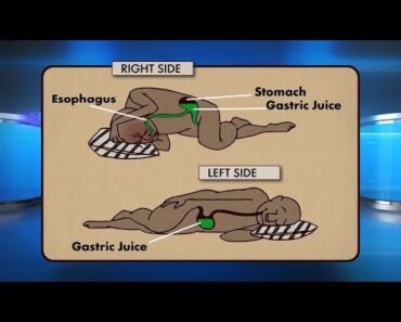 CAUTION if you sleep on your right side…See More – Daily News