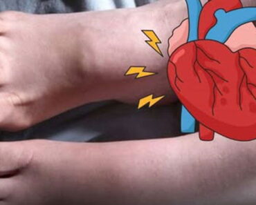 One Month Before A Heart Attack, Your Feet Will W.arn You Of These 6 Signs
